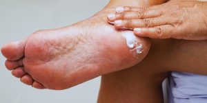 Close na base de um pé feminino e uma mão passando creme